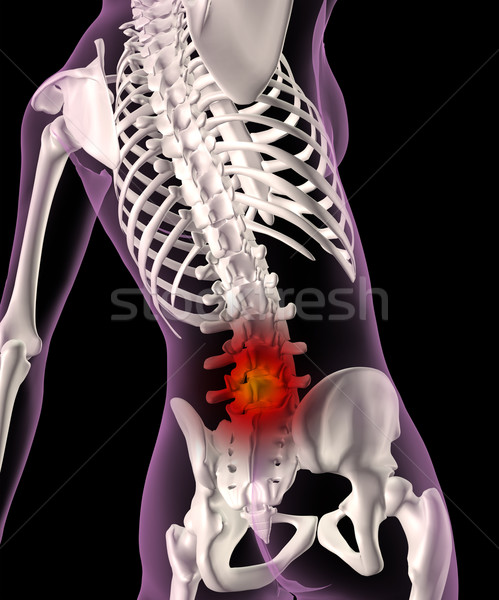 Zdjęcia stock: Powrót · ból · kobiet · szkielet · 3d · medycznych