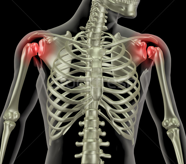 Stock photo: Shoulder pain