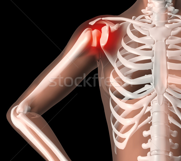 Weiblichen Skelett Schulterschmerzen 3d render medizinischen Innenraum Stock foto © kjpargeter