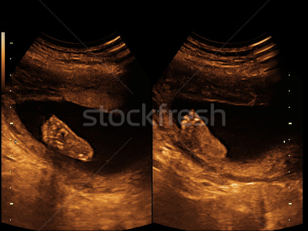 [[stock_photo]]: Enfant · photos · ultrasons · bébé · visage · homme