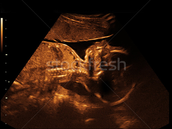 Dziecko zdjęcie ultradźwięk baby twarz człowiek Zdjęcia stock © koca777