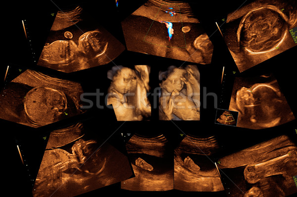 Bebé ultrasonido imagen cara hombre corazón Foto stock © koca777