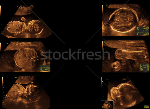 嬰兒 超聲 圖像 面對 男子 心臟 商業照片 © koca777