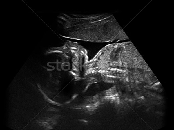 Nino Foto ultrasonido bebé cara hombre Foto stock © koca777