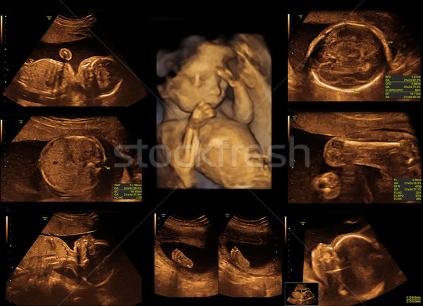 Baby ultradźwięk obraz twarz człowiek serca Zdjęcia stock © koca777