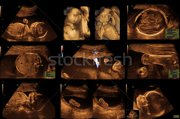 Baby ultrageluid afbeelding gezicht man hart Stockfoto © koca777