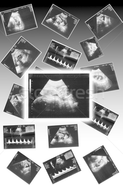 赤ちゃん 超音波 画像 女性 男 医療 ストックフォト © koca777