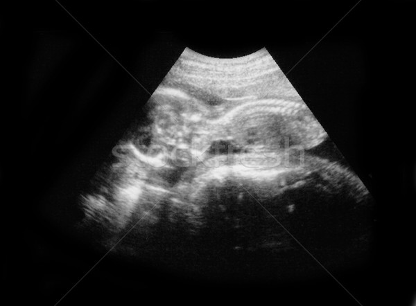 Kind foto ultrageluid baby gezicht man Stockfoto © koca777