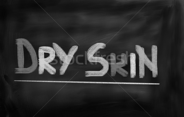 Dry Skin Concept Stock photo © KrasimiraNevenova