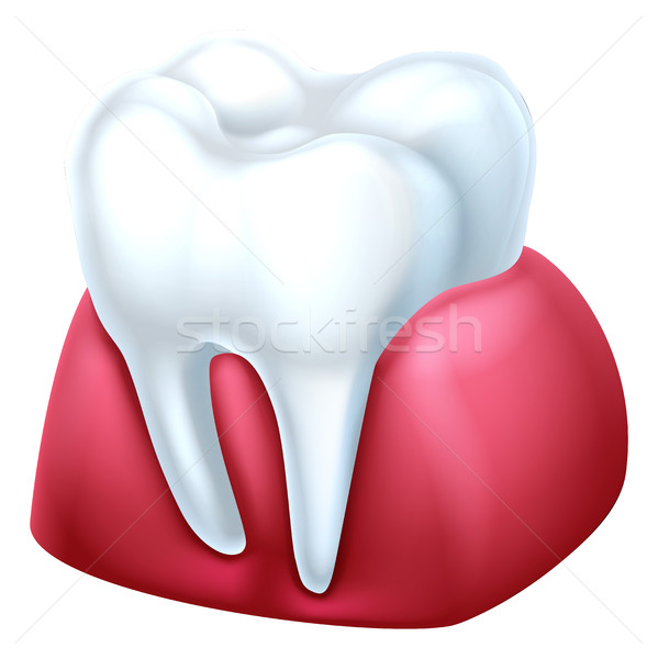камедь зубов стоматологических медицинской иллюстрация здоровья Сток-фото © Krisdog