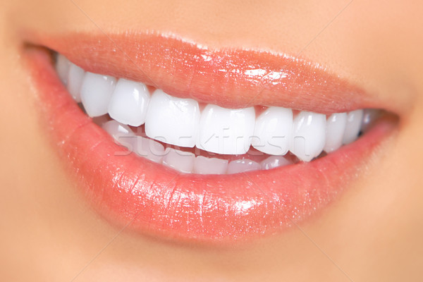 Nő fogak mosolygó nő száj nagyszerű közelkép Stock fotó © Kurhan