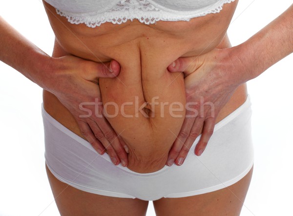 Nő kövér has túlsúlyos fogyókúra test Stock fotó © Kurhan