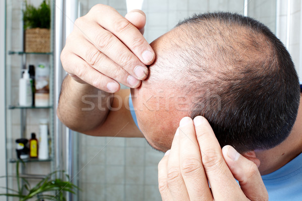 Hair loss. Stock photo © Kurhan