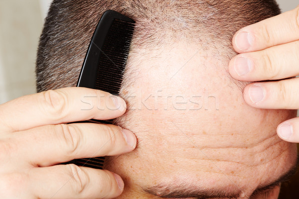 Uomo testa pettine primo piano capelli perdita Foto d'archivio © Kurhan