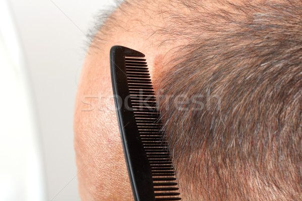 Homme tête peigne cheveux perte [[stock_photo]] © Kurhan