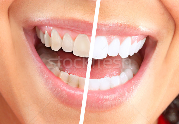 Stockfoto: Gelukkig · glimlachende · vrouw · tandheelkundige · gezondheid · meisje · glimlach