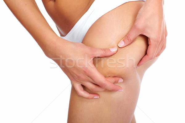 Femeie celulita izolat alb corp fitness Imagine de stoc © Kurhan