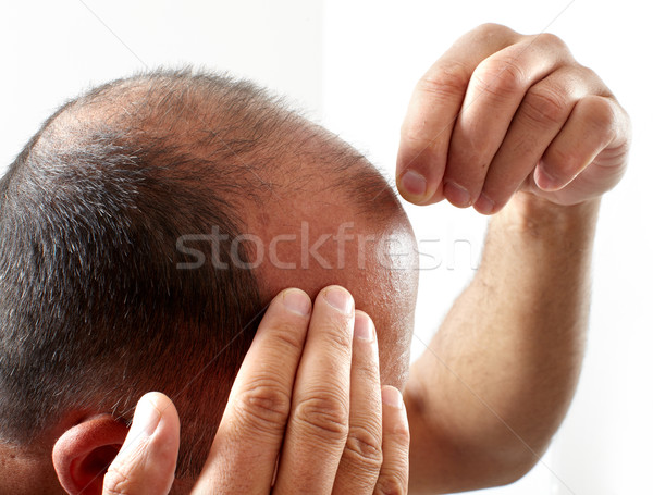 Hair loss. Stock photo © Kurhan