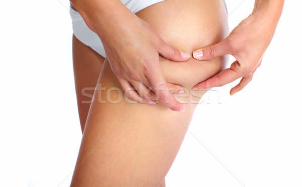 Femme cellulite régime alimentaire fitness isolé blanche Photo stock © Kurhan