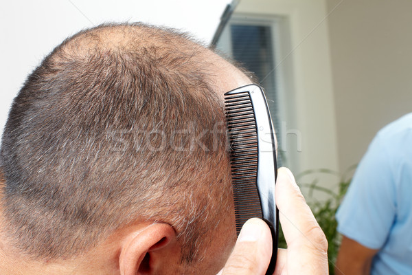 Adam kafa tarak saç kayıp Stok fotoğraf © Kurhan