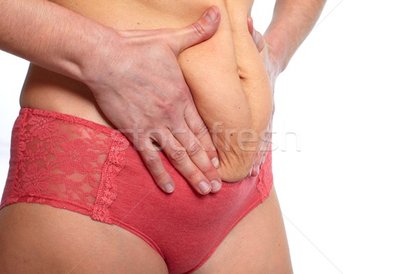 Foto stock: Gordura · estômago · mulher · barriga · excesso · de · peso