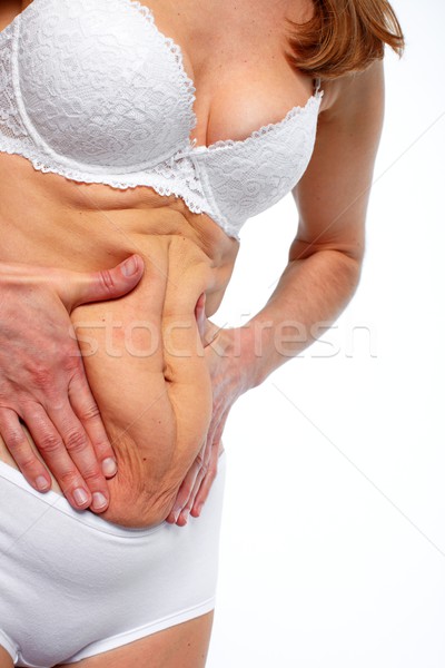 Foto stock: Mulher · gordura · barriga · dieta · saúde