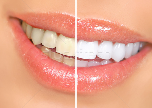 Nő fogak mosolygó nő száj nagyszerű fehér Stock fotó © Kurhan