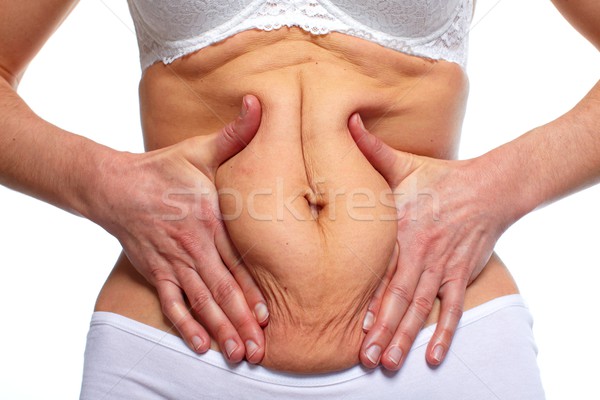 Mujer grasa vientre sobrepeso cuerpo Foto stock © Kurhan