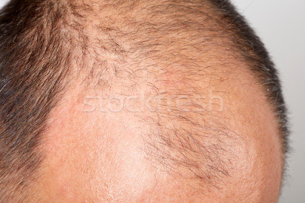 Man head with a comb. Stock photo © Kurhan