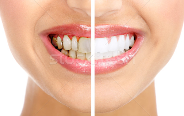 Lächeln gesunden schönen zahnärztliche Gesundheit Stock foto © Kurhan