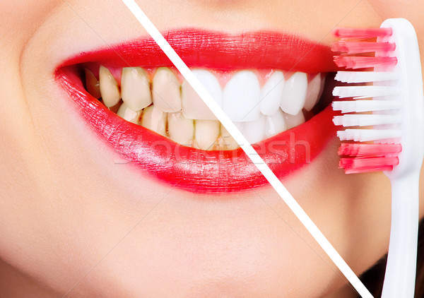 Sonrisa saludable hermosa dentales salud blanqueo Foto stock © Kurhan