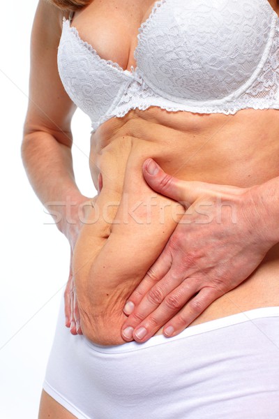 Stock photo: Woman fat belly.