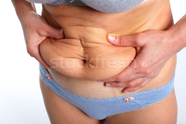 женщину жира живота избыточный вес стороны Сток-фото © Kurhan