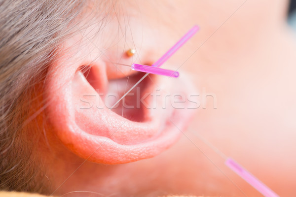 Ear of woman with acupuncture needles Stock photo © Kzenon