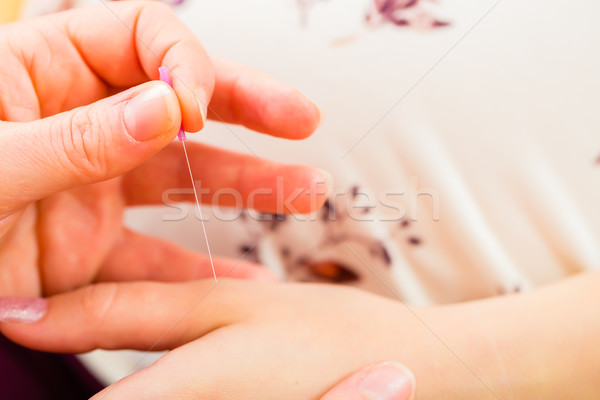 Midwife giving pregnancy acupuncture Stock photo © Kzenon