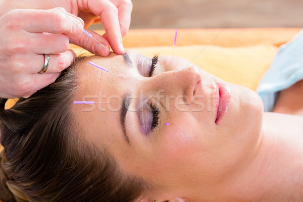 Therapist setting acupuncture needles Stock photo © Kzenon