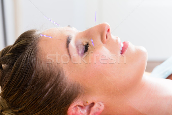 Woman at acupuncture with needles in face Stock photo © Kzenon