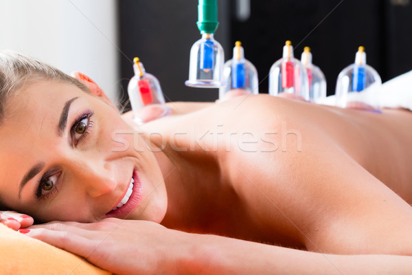 Woman in alternative medical cupping therapy Stock photo © Kzenon