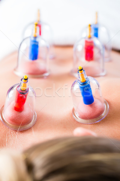 Alternative practitioner cupping woman Stock photo © Kzenon