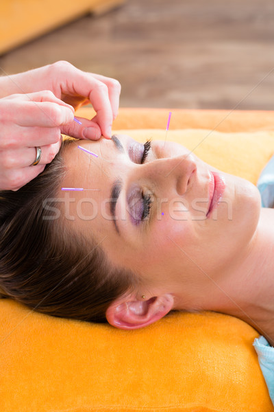 Terapeuta akupunktúra tűk nő kezelés lány Stock fotó © Kzenon