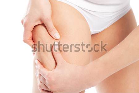 Cellulit ciało piękna kobieta testowanie skóry Zdjęcia stock © Kzenon