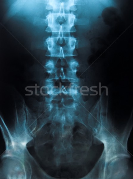 Xray jungen männlich Wirbelsäule Radiographie Arzt Stock foto © ldambies