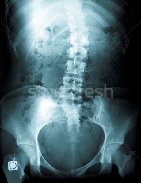 Xray jungen weiblichen Wirbelsäule Radiographie Arzt Stock foto © ldambies