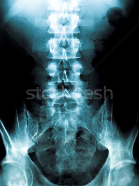 Xray jungen männlich Wirbelsäule Radiographie medizinischen Stock foto © ldambies