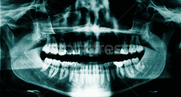 стоматологических Xray панорамный мужчины врач Сток-фото © ldambies