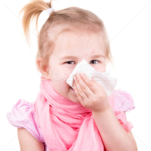 Stock photo: Sick little girl with chickenpox with napkin
