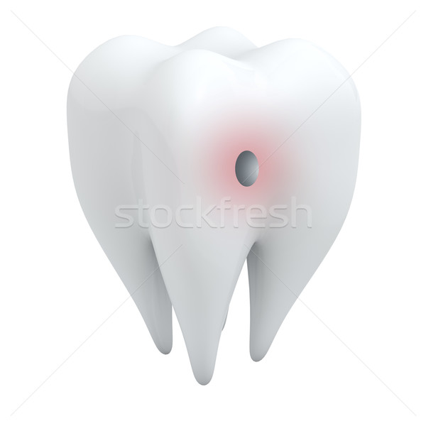 Zębów otwór odizolowany biały medycznych Zdjęcia stock © lenapix