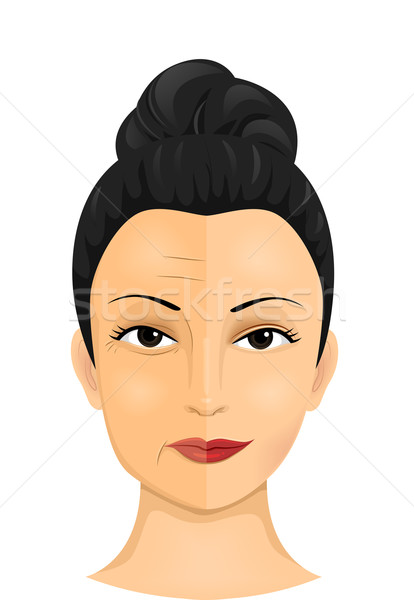 整容手術 皺紋 插圖 女子 顯示 差異 商業照片 © lenm