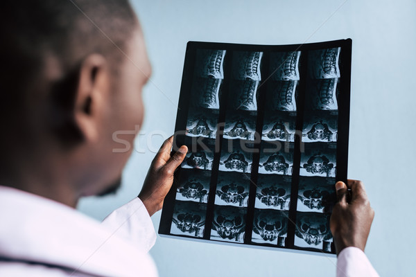 african american doctor with xray picture Stock photo © LightFieldStudios