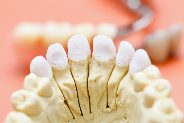 Dişler diş seramik taç sağlık tıp Stok fotoğraf © Lighthunter